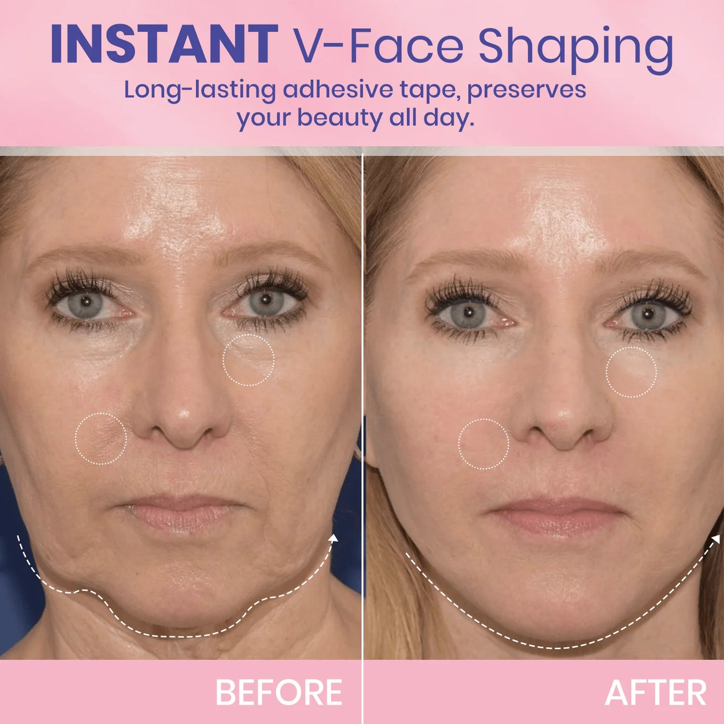 InvisiLift™ | Invisible Adhesive Tape for Facial Lifting