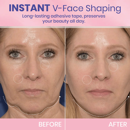 InvisiLift™ | Invisible Adhesive Tape for Facial Lifting
