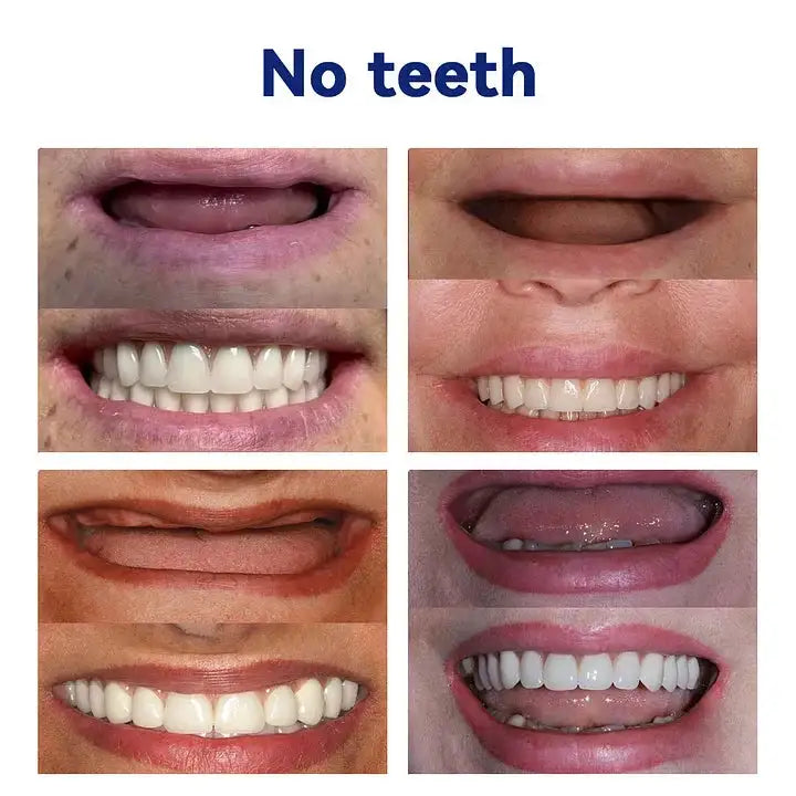 DentureSet Pro | Complete Denture Set