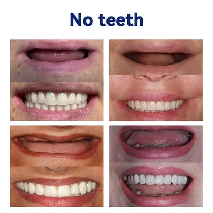 DentureSet Pro | Complete Denture Set